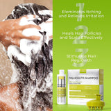 Anti Fungal Folliculitis Shampoo, Seborrheic Dermatitis Shampoo, Anti Dandruff Shampoo, Folliculitis Treatment, Dandruff Treatment, Scalp Psoriasis Treatment, Relieve From Itchy & Dry Scalp